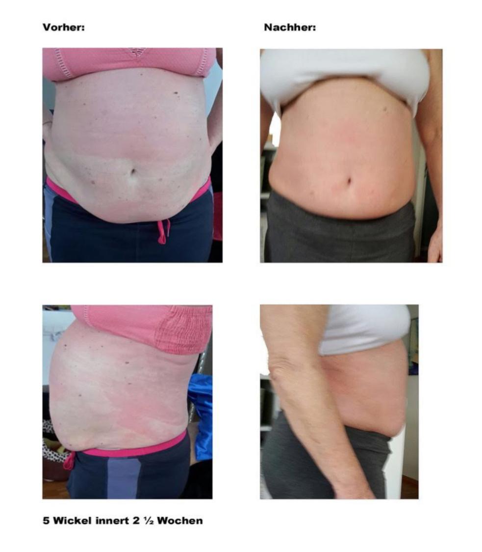 Madero Therapie Wohlen Madero Therapie Wohlen